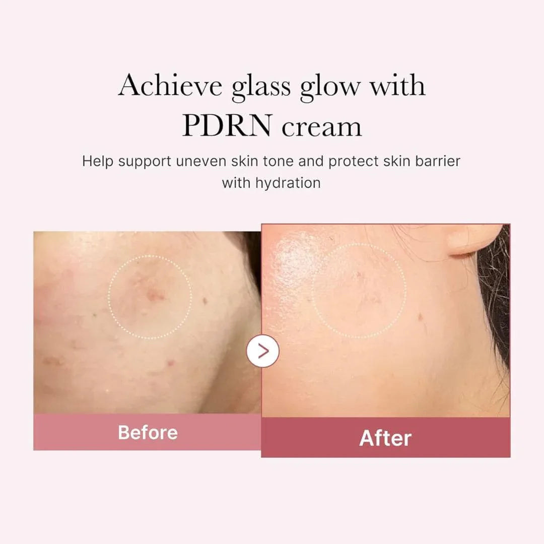 MedicubePDRNPinkHyaluronicMoisturizingCream3 - GlowTheory Co